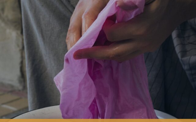 Acid vs Direct vs Reactive Dyes: Complete Comparison
